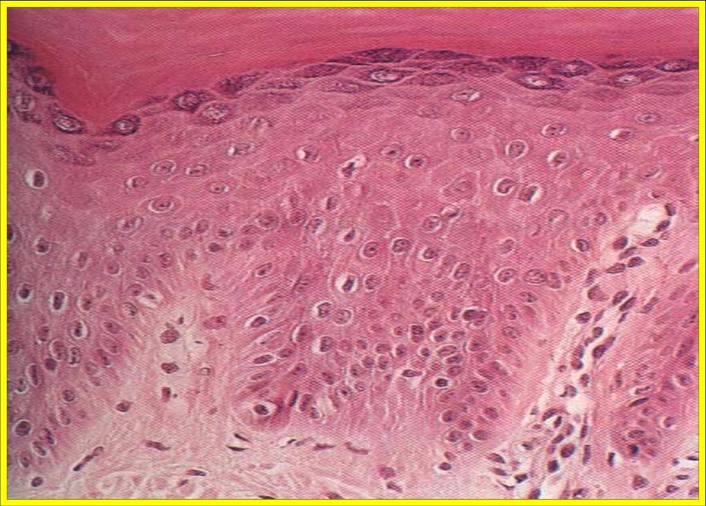 Epidermis Nedir?