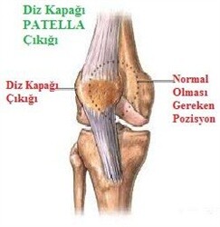 8563_patella