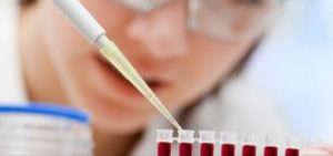 BUN Testi Nedir?