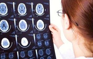 N&ouml;ropsikoloji Ve Klinik Değerlendirme