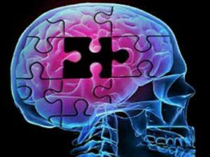 Alzheimer Başlangıcını G&ouml;steren 10 Belirti ve &Ouml;neriler