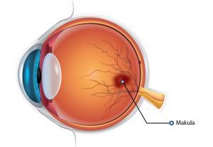 Diyabetik Göz Hastalıkları ve Korunma Yolları