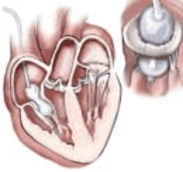 bolum22_14