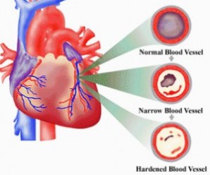 Kalp Hastalıklarının Tedavisinde Yeni Buluşlar