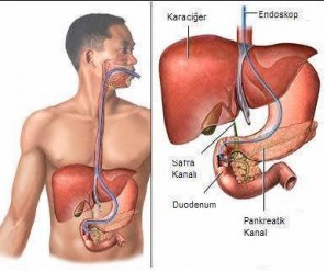 Karaciğerin Yapısı, Önemi ve Karaciğere Bağlı Hastalıklar