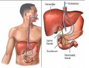 Karaciğerin Yapısı, Önemi ve Karaciğere Bağlı Hastalıklar