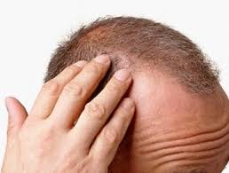 Saç Dökülmelerine Karşı ve Genel Saç Bakımına Dair Doğal Çözümler