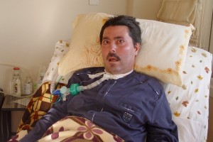 ALS/MNH Hastalığı Nedir? Tedavisi Mümkün Müdür?