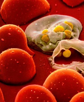 Aids Nedir? Nasıl Bulaşır? HIV Virüsünden Korunma Yolları Nelerdir?