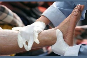Damar Sertliği Nedir? Belirtileri ve Tedavi Yöntemleri Nelerdir?