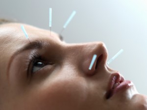 Akupunktur Nedir? Nasıl Uygulanır?