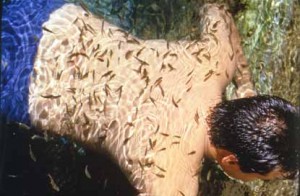 Sedef Hastalığı(Psoriasis) Nedir? Tedavi Yöntemleri Nelerdir?