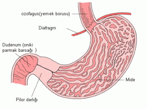Pilorik Stenoz (Mide Çıkısı Tıkanması) Nedir?