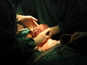 Sezaryen Nedir? Hangi Durumlarda Uygulanır?