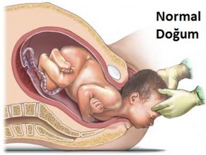 Sezaryen Nedir? Hangi Durumlarda Uygulanır?