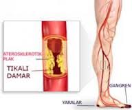 3097_damar