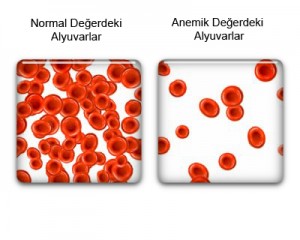 kansizlik