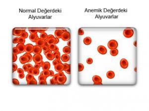 4252_demir-eksikligi-anemisi