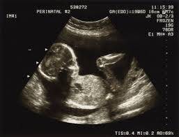 4388_baby