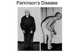 4493_parkinsm