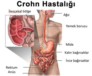 4925_croh