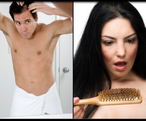 Saç Dökülmesi Nedenleri ve Tedavisi
