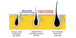 5134_minoxidil_andcopperpeptides