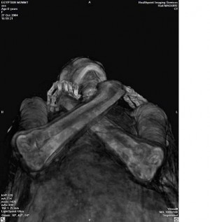 5170_lazarus_refleksili_mummy