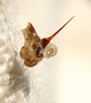 5314_bee-sting-abeille-dard-2