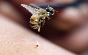 5314_bee-sting_1626213c
