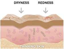 5333_thinning-skin
