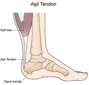 5660_asil-tendiniti