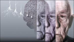 6117_alzheimer-_demans-5