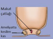 6508_makat_catlagi