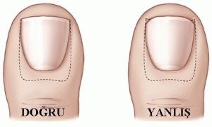 6583_el_ve_ayak_tirnaklarinin_bakimi_nasil_yapilmalidir