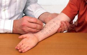 7380_allergy_1692889c