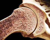 8398_bone