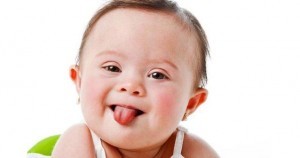 Down Sendromu Nedir?