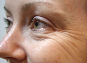 Rhytifobi Nedir?
