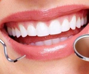 Diş Eti Çekilmesi Neden Olur? Diş Sağlığı İçin Neler Yapmalıyız?