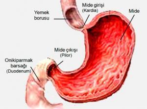 Gastrit Çeşitleri, Nedenleri Ve Tedavisi