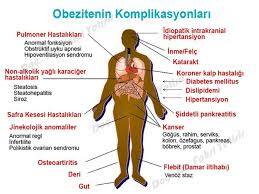 Obezite: Çok Kilo Alma Hastalığı Kimlerde Görülür ?