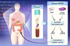 Sekiz Kanser Türü İçin Geliştirilen "CancerSEEK" Test Paneli Nasıl Çalışıyor?