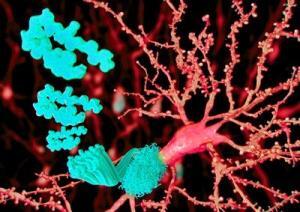 Alzheimer Başlamadan Önlenebilir mi?
