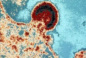 Emziren Anneden Bebeğe HIV Aktarılması Önlenebiliyor mu?
