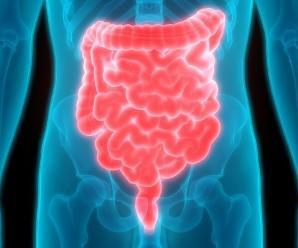 Crohn Hastalığı (İltihabi Bağırsak Hastalığı-İBH)