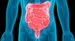 Crohn Hastalığı (İltihabi Bağırsak Hastalığı-İBH)
