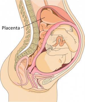 Epidural Anestezi Hangi Durumlarda Uygulanır ?