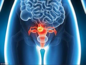Hipermenore Nedir?