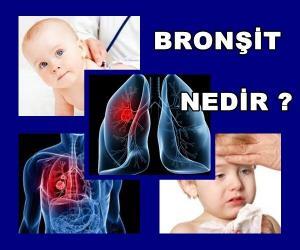 Bronşit Nedir, Belirtileri ve Tedavisi Nasıldır ?